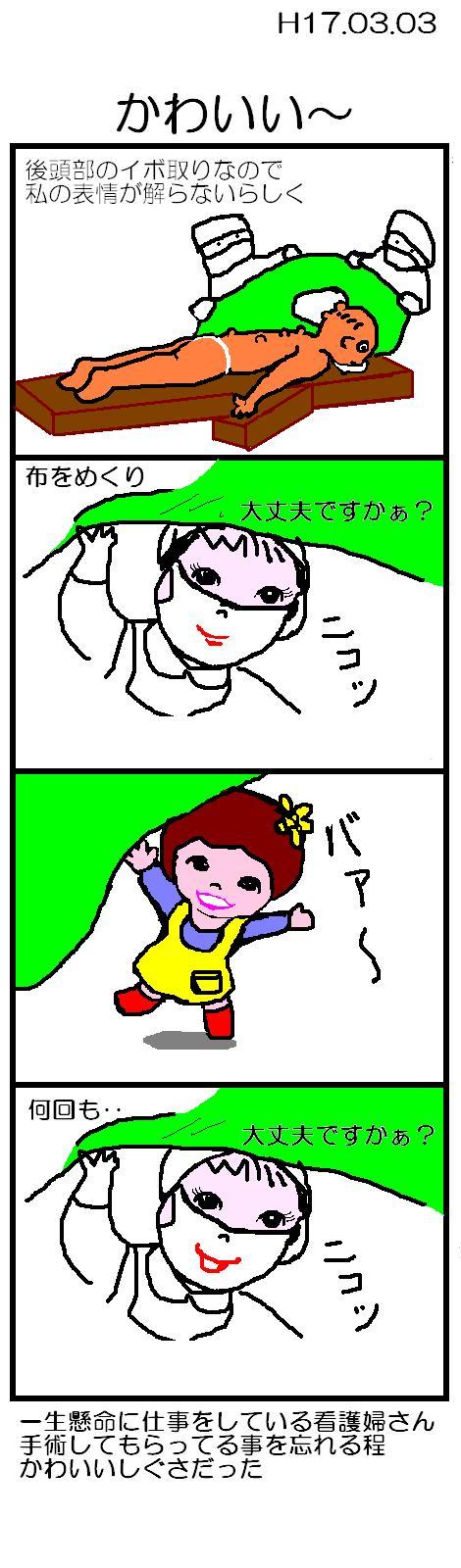 킢